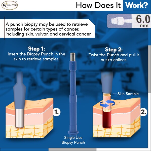 Disposable Biopsy Punch, Size 6.0mm, PK10