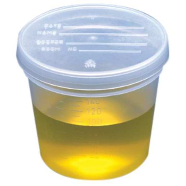 Specimen Container, 5 oz., 300 Pack