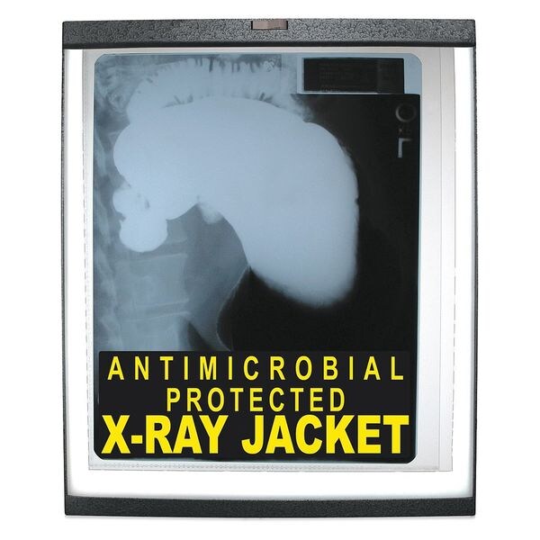 X-Ray Jackets, 19 x 14-1/4